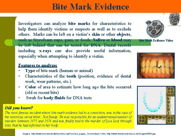 Bite Mark Evidence Investigators can analyze bite marks for characteristics to help them identify