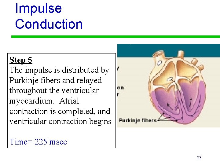 Impulse Conduction Step 5 The impulse is distributed by Purkinje fibers and relayed throughout