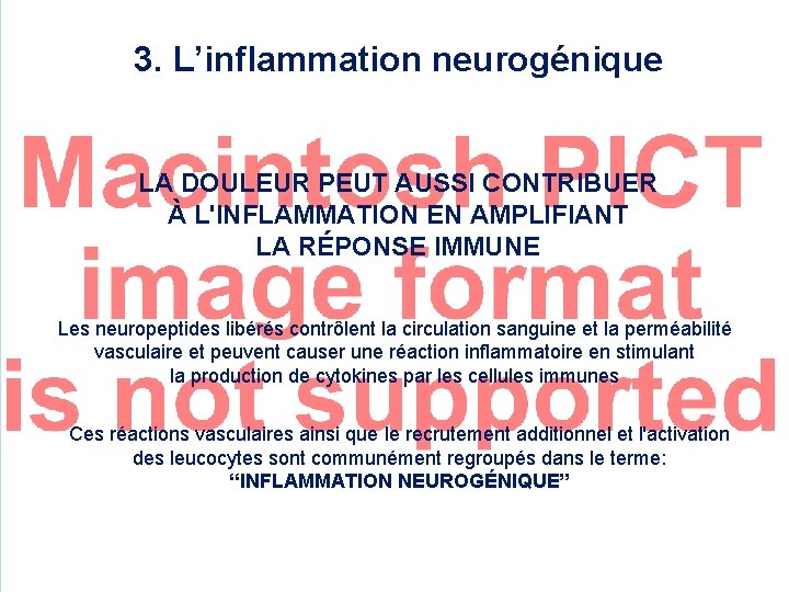 3. L’inflammation neurogénique LA DOULEUR PEUT AUSSI CONTRIBUER À L'INFLAMMATION EN AMPLIFIANT LA RÉPONSE