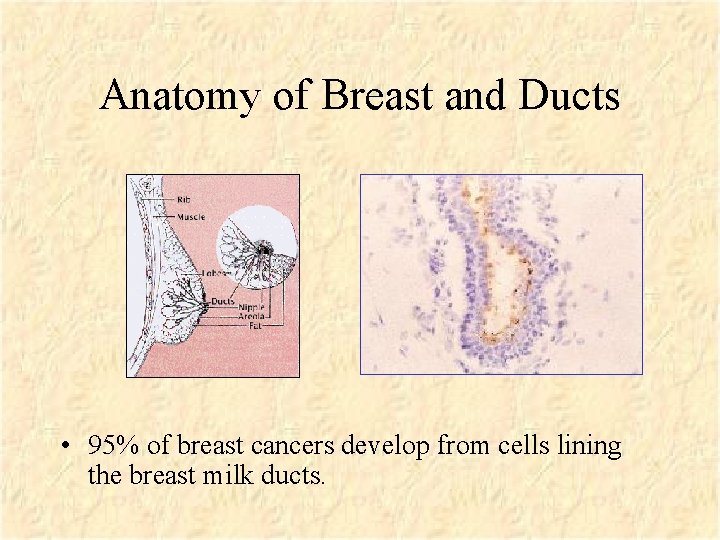 Anatomy of Breast and Ducts • 95% of breast cancers develop from cells lining