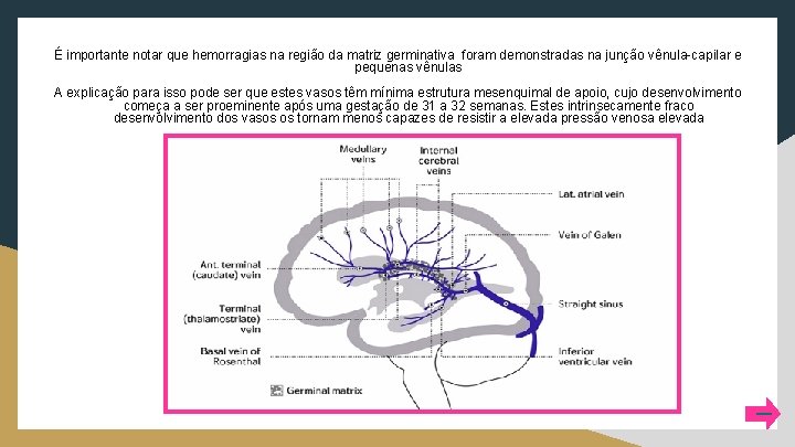 É importante notar que hemorragias na região da matriz germinativa foram demonstradas na junção