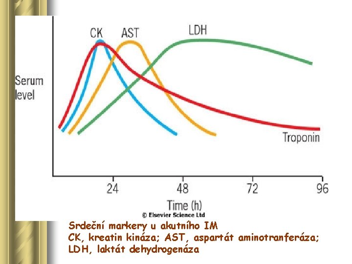Srdeční markery u akutního IM CK, kreatin kináza; AST, aspartát aminotranferáza; LDH, laktát dehydrogenáza