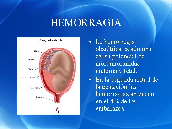 HEMORRAGIA • La hemorragia obstétrica es aún una causa potencial de morbimortalidad materna y