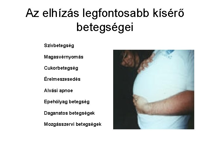 Az elhízás legfontosabb kísérő betegségei Szívbetegség Magasvérnyomás Cukorbetegség Érelmeszesedés Alvási apnoe Epehólyag betegség Daganatos