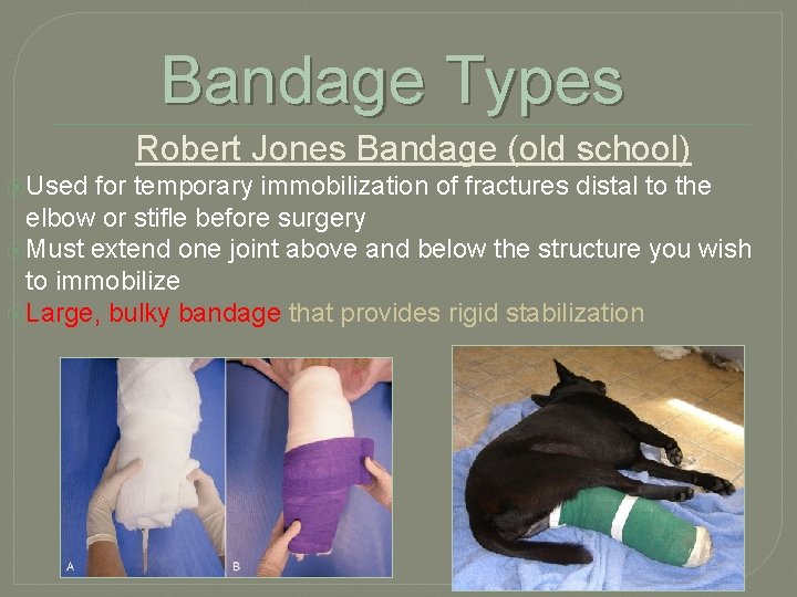 Bandage Types Robert Jones Bandage (old school) ⦿Used for temporary immobilization of fractures distal