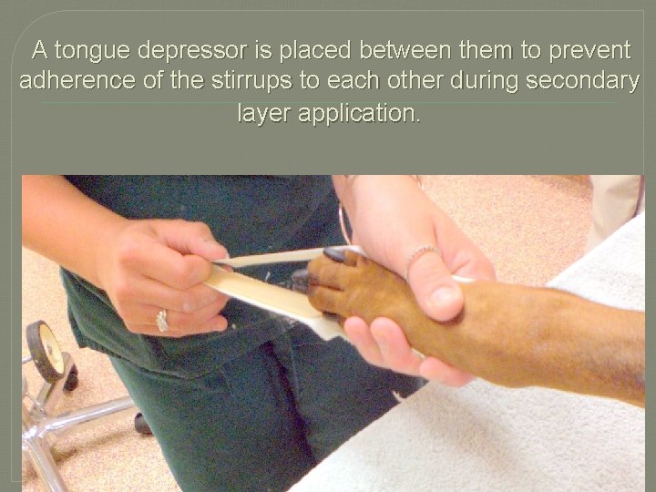A tongue depressor is placed between them to prevent adherence of the stirrups to