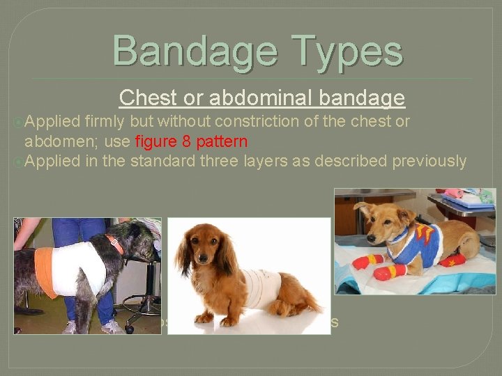 Bandage Types Chest or abdominal bandage ⦿Applied firmly but without constriction of the chest