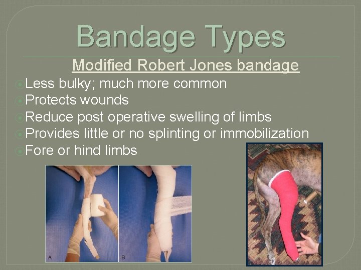 Bandage Types Modified Robert Jones bandage ⦿Less bulky; much more common ⦿Protects wounds ⦿Reduce