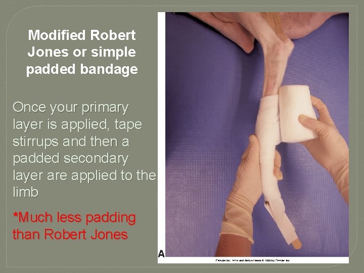 Modified Robert Jones or simple padded bandage Once your primary layer is applied, tape