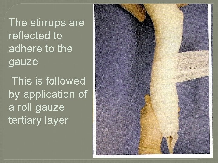 The stirrups are reflected to adhere to the gauze This is followed by application