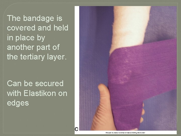 The bandage is covered and held in place by another part of the tertiary