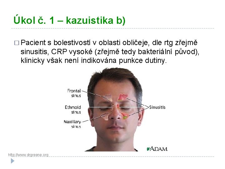 Úkol č. 1 – kazuistika b) � Pacient s bolestivostí v oblasti obličeje, dle