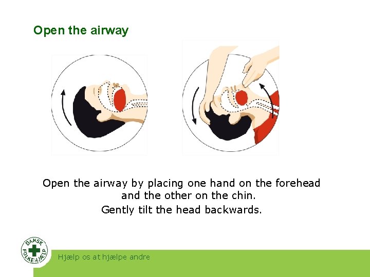Open the airway by placing one hand on the forehead and the other on