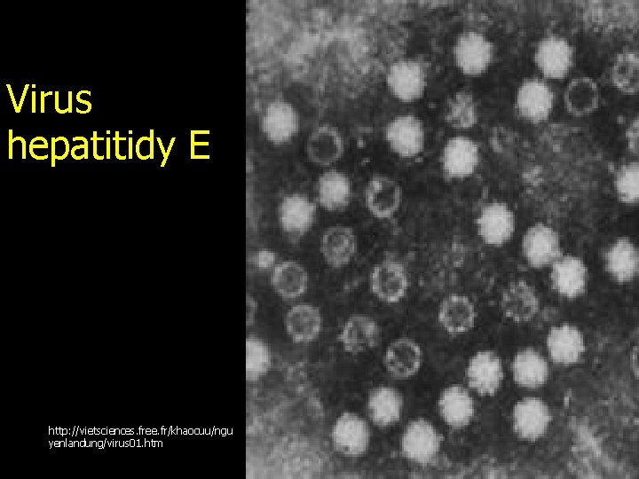 Virus hepatitidy E http: //vietsciences. free. fr/khaocuu/ngu yenlandung/virus 01. htm 