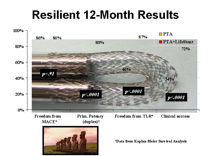 Resilient 12 -Month Results 100% 86% 87% 86% 80% PTA+Life. Stent 72% 60% 40%