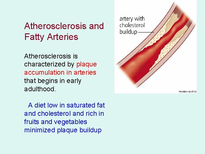 Atherosclerosis and Fatty Arteries Atherosclerosis is characterized by plaque accumulation in arteries that begins