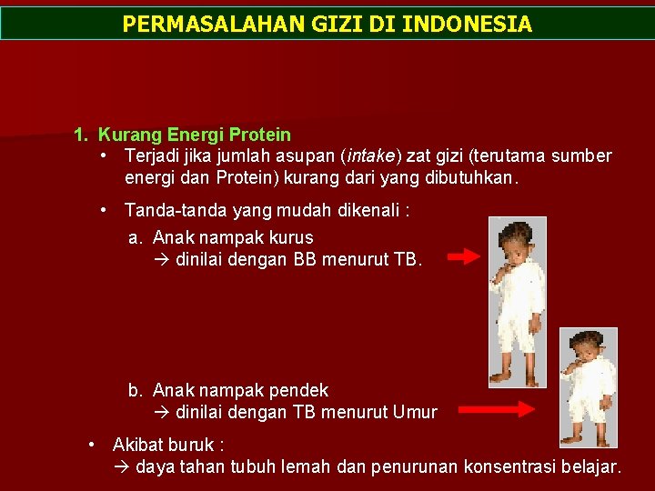 PERMASALAHAN GIZI DI INDONESIA 1. Kurang Energi Protein • Terjadi jika jumlah asupan (intake)