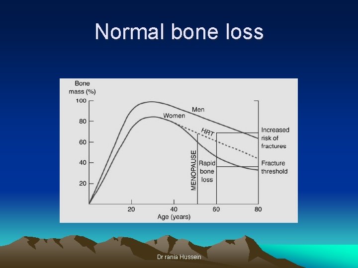 Normal bone loss Dr rania Hussein 