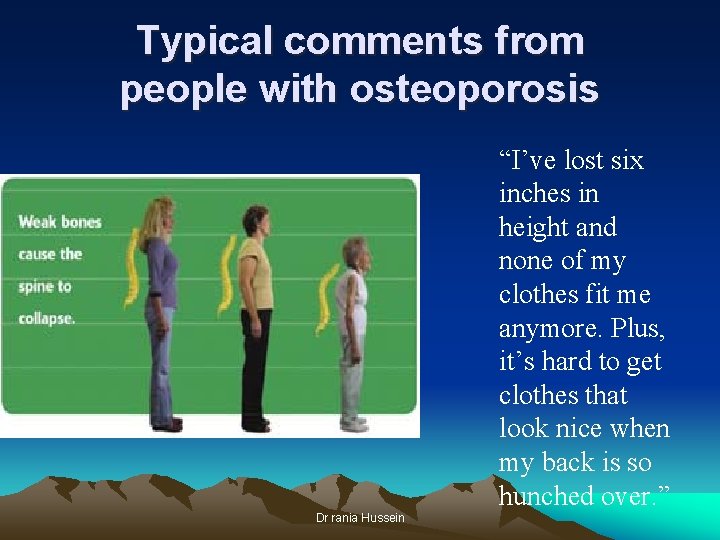 Typical comments from people with osteoporosis “I’ve lost six inches in height and none