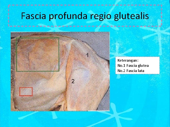Fascia profunda regio glutealis Keterangan: No. 1 Fascia glutea No. 2 Fascia lata 