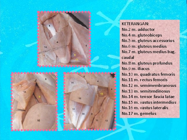 KETERANGAN: No. 2 m. adductor No. 4 m. gluteobiceps No. 5 m. gluteus accessorius
