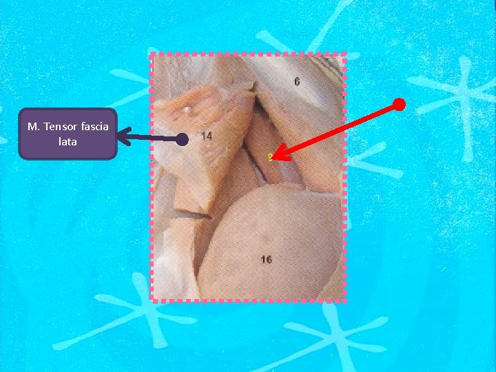 M. Tensor fascia lata 