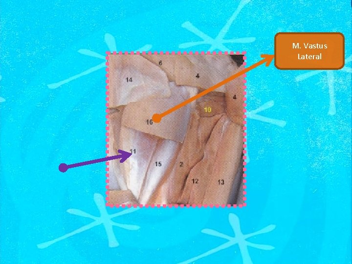 M. Vastus Lateral 