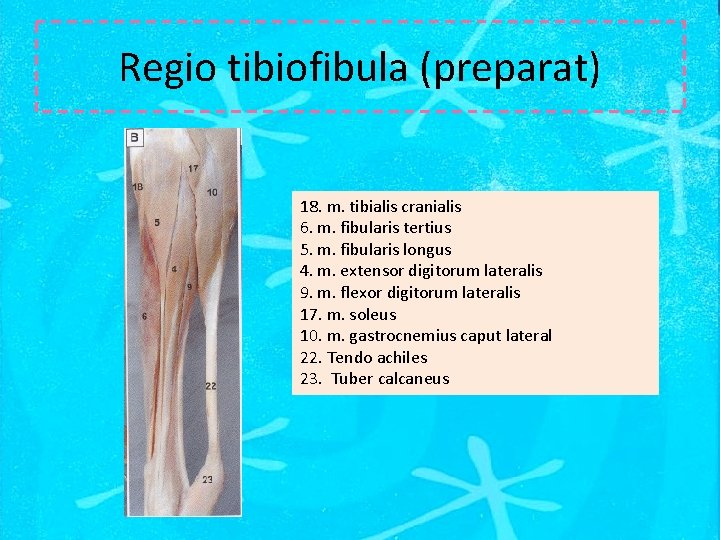 Regio tibiofibula (preparat) 18. m. tibialis cranialis 6. m. fibularis tertius 5. m. fibularis