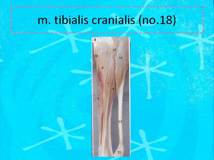 m. tibialis cranialis (no. 18) 