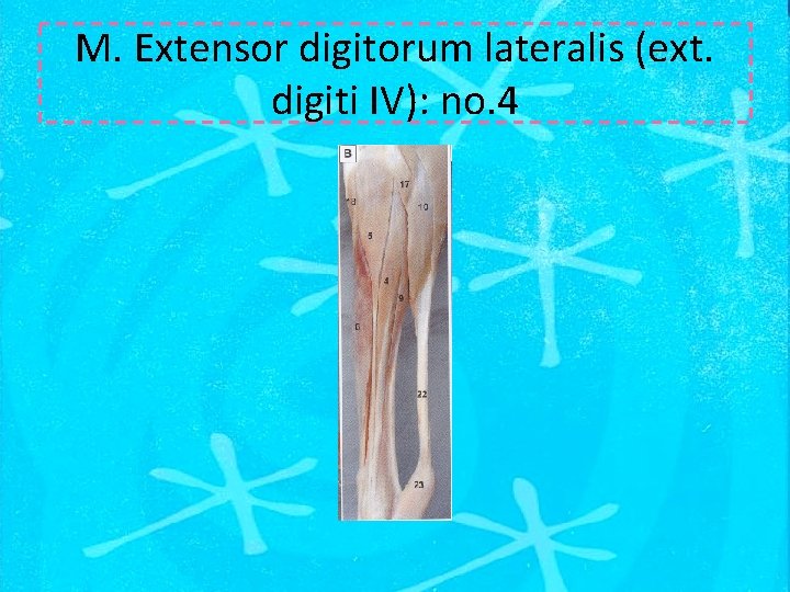 M. Extensor digitorum lateralis (ext. digiti IV): no. 4 