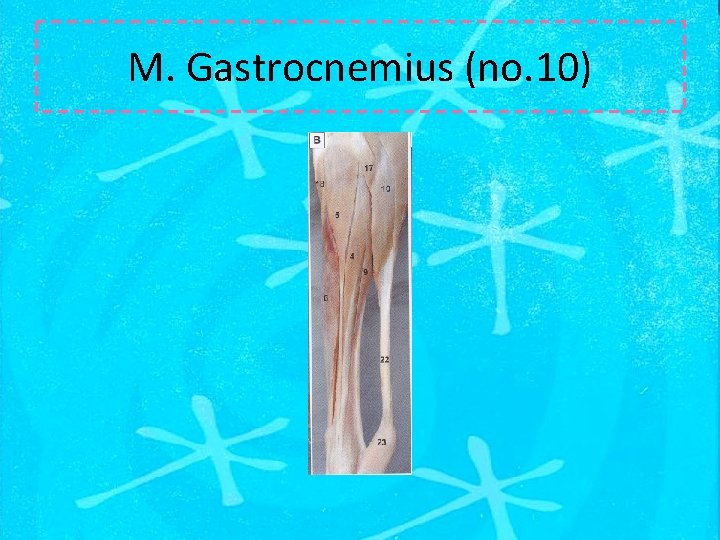 M. Gastrocnemius (no. 10) 
