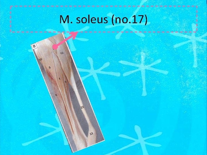 M. soleus (no. 17) 