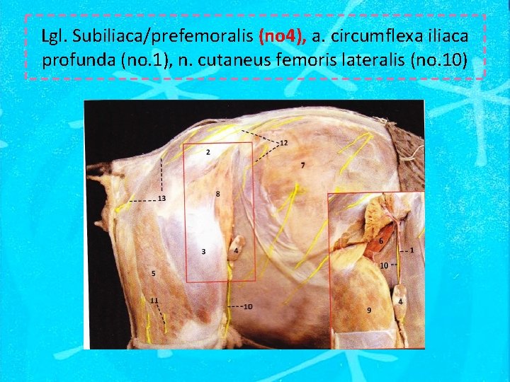Lgl. Subiliaca/prefemoralis (no 4), a. circumflexa iliaca profunda (no. 1), n. cutaneus femoris lateralis