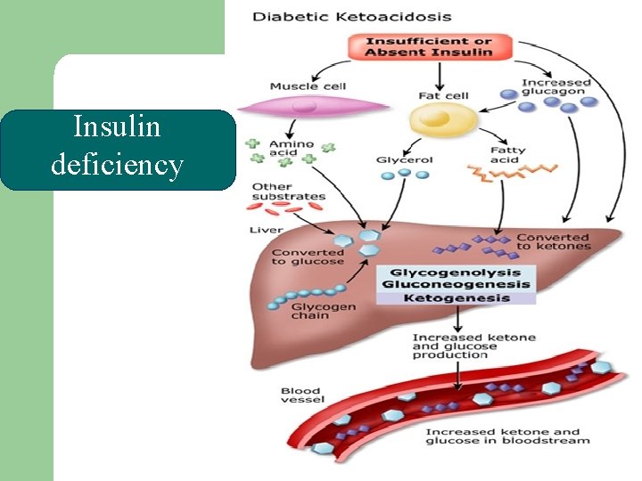 Insulin deficiency 
