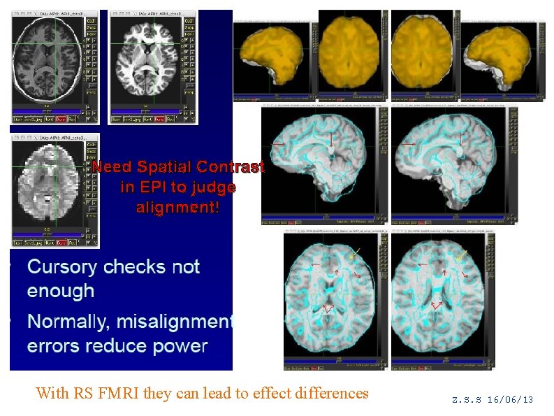 Need Spatial Contrast in EPI to judge alignment! With RS FMRI they can lead