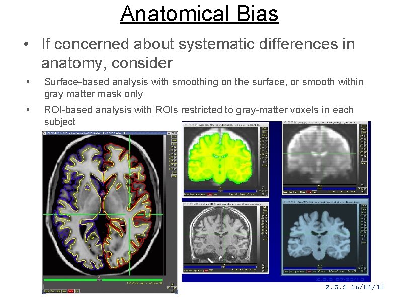 Anatomical Bias • If concerned about systematic differences in anatomy, consider • Surface-based analysis