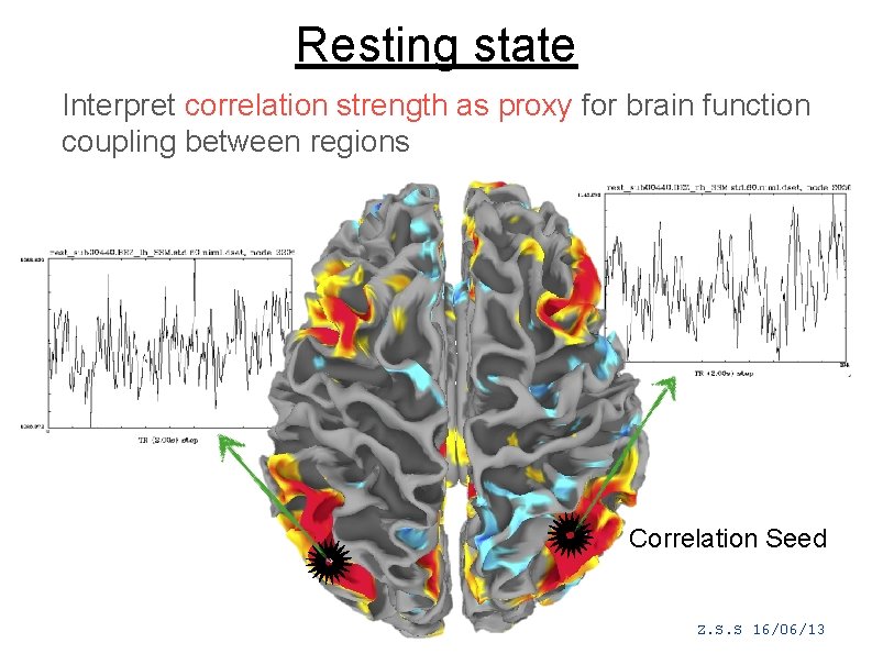 Resting state Interpret correlation strength as proxy for brain function coupling between regions Correlation