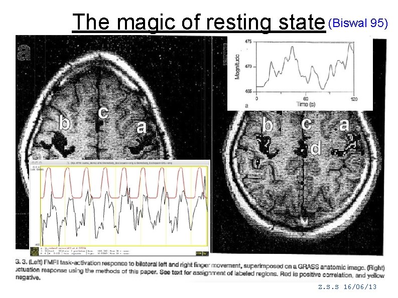 The magic of resting state (Biswal 95) Z. S. S 16/06/13 