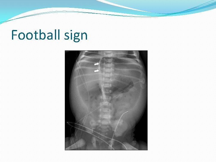 Football sign 