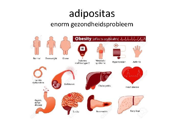 adipositas enorm gezondheidsprobleem 