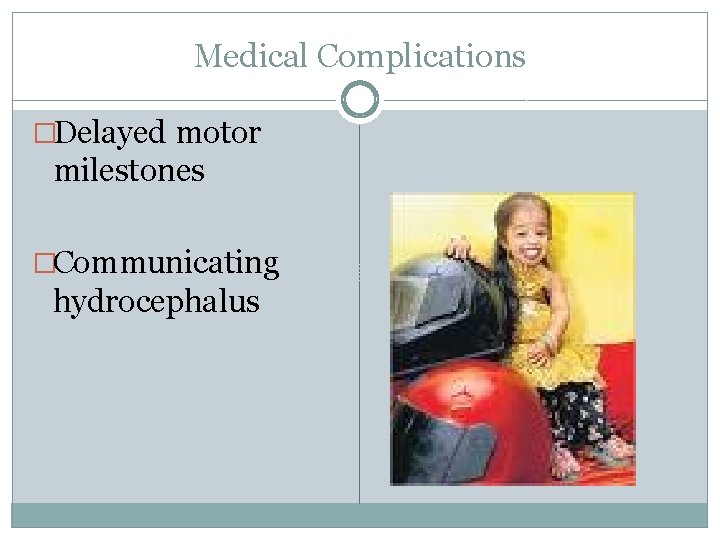 Medical Complications �Delayed motor milestones �Communicating hydrocephalus 