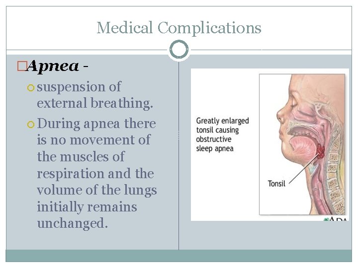Medical Complications �Apnea suspension of external breathing. During apnea there is no movement of