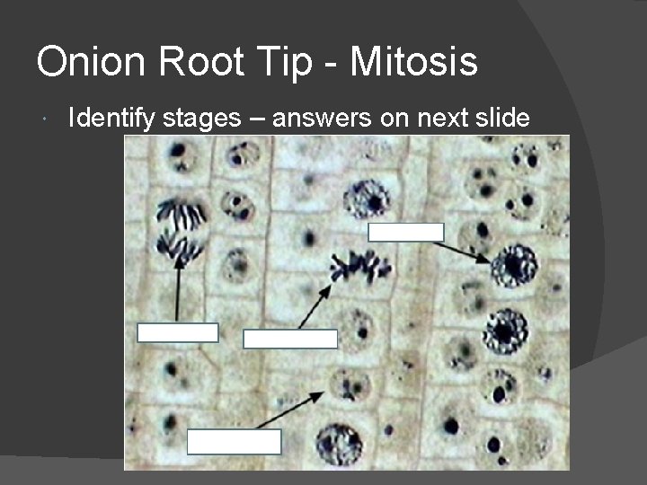 Onion Root Tip - Mitosis Identify stages – answers on next slide 