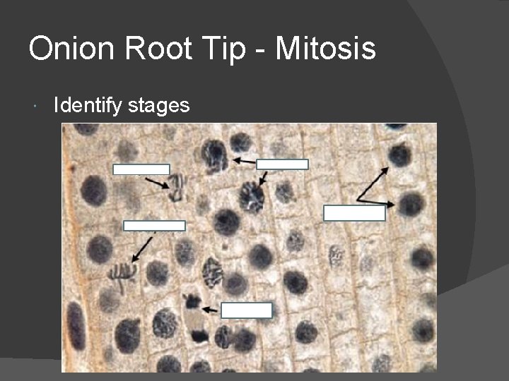 Onion Root Tip - Mitosis Identify stages 