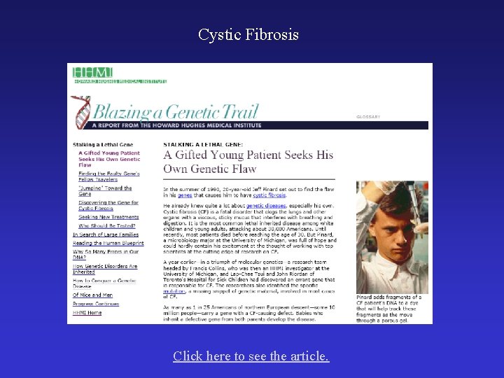Cystic Fibrosis Click here to see the article. 
