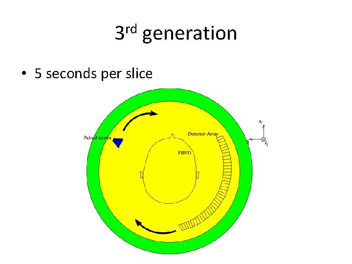 3 rd generation • 5 seconds per slice 