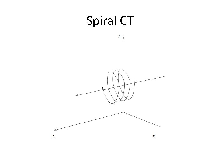 Spiral CT 