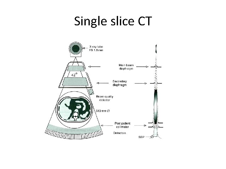 Single slice CT 