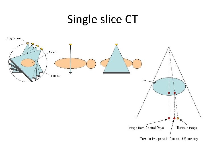 Single slice CT 
