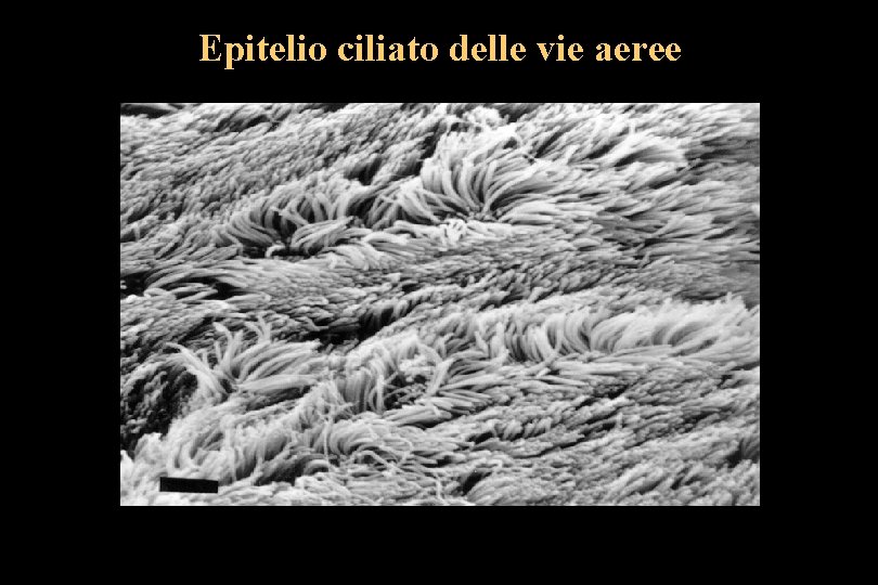 Epitelio ciliato delle vie aeree 